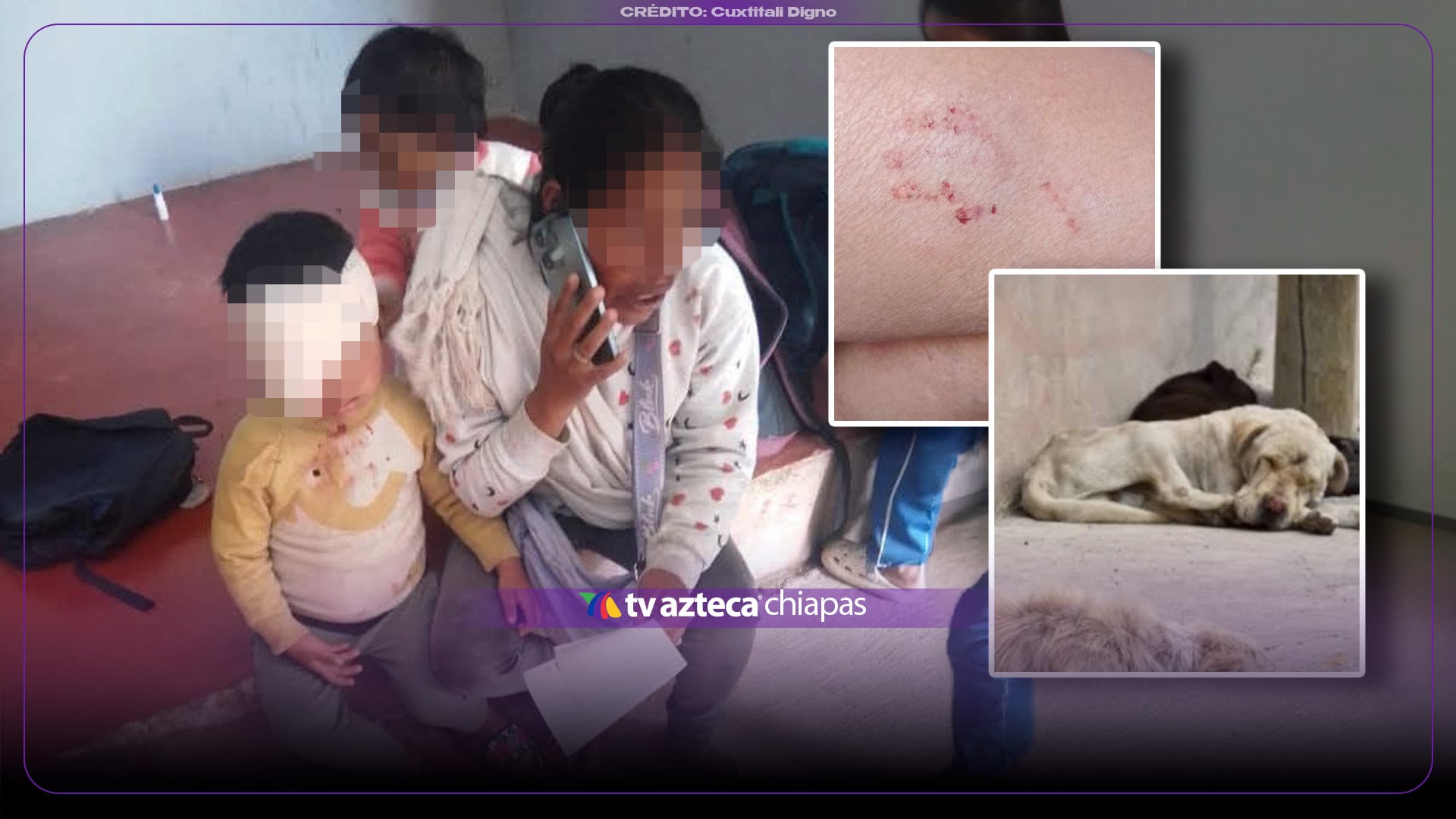 Niño es brutalmente atacado por un perro en el rostro en San Cristóbal de Las Casas
