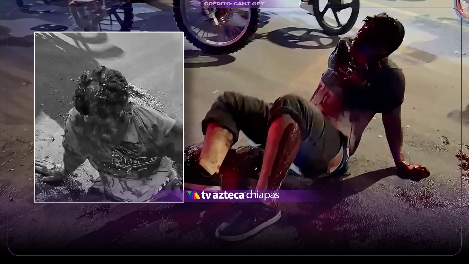 VIDEO: ¡Se le ve hasta el cráneo! Joven sufre severo traumatismo craneal tras accidentarse en la vía pública